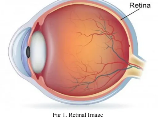 Fig 1. Retinal Image  