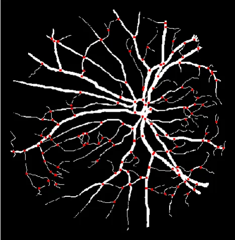 Fig 2: Retinal image processing  
