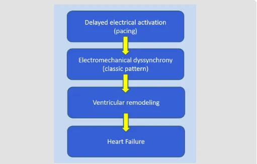Figure 3: The pathophysiologic sequence of electrical activation leading to dyssynchrony, ventricular remodeling and eventually heart failure.