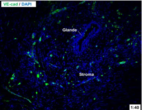 Figure 1 – Vascular network of a recto-vaginal endometriotic lesion. Blue, nuclear DAPI immunostaining; Green, VE-cad endothelial immunostaining