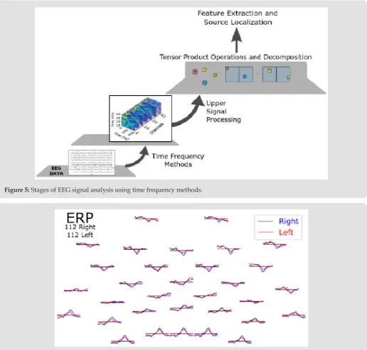Figure 5: Stages of EEG signal analysis using time frequency methods.