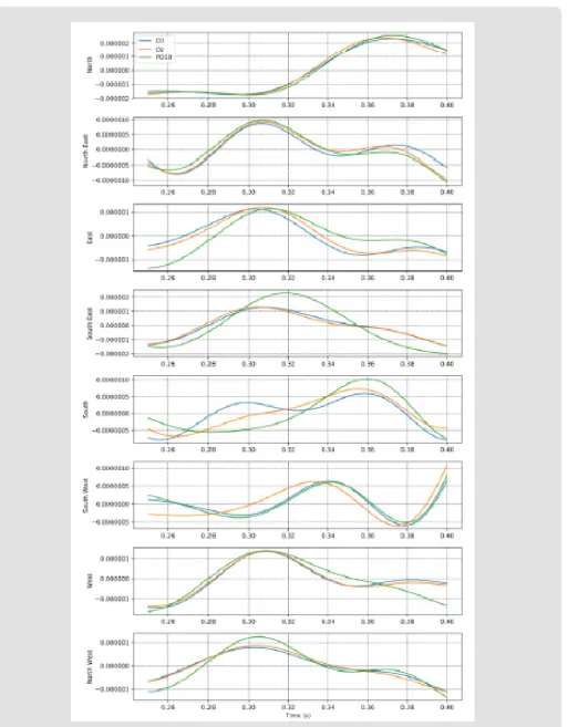 Figure 10: Time Delay Eight Class, Three Features Evoked Potentials.
