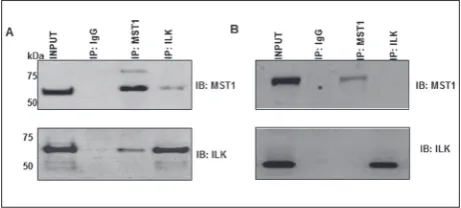 Fig. 2. MST1 negatively regulates osteoclast differentiation. Overexpression and knockdown of MST1 were per-formed and evaluated for changes in osteoclast differentiation by TRAP and pit formation assays