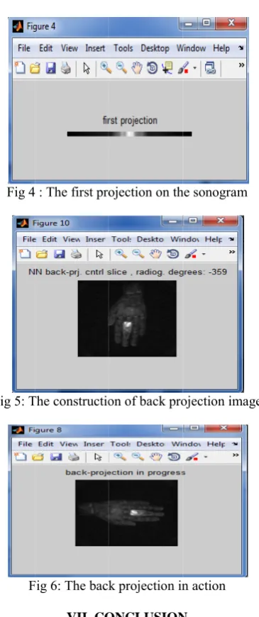 Fig 44 : The first pro