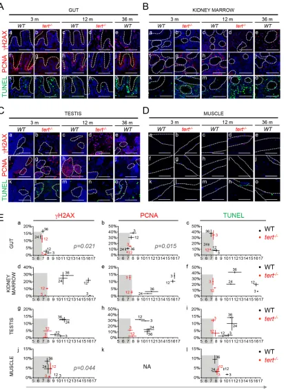 Fig 3. Shortening of mTL anticipates accumulation of DDR markers, decrease in cell proliferation and increase in apoptotis with age