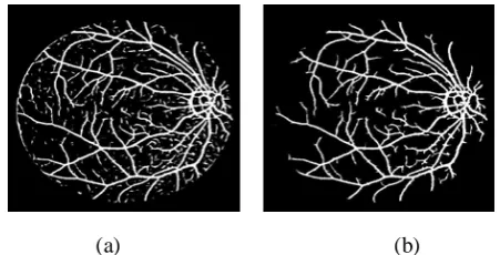 FIGURE 6: Segmented vessels; (a) Thresholded response image; (b) Final segmented image after removing unconnected pixels