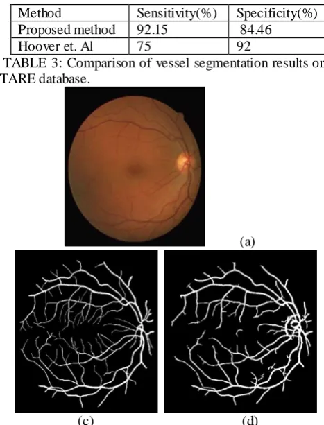 FIGURE 8: Result of vessel segmentation on image from DRIVE segmentation by expert; (c) Automatic Segmentation by the 
