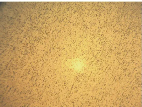 Figure 6. Micrograph of Al-12wt%Si + 1.0% Na flux alloy casting (400×). 