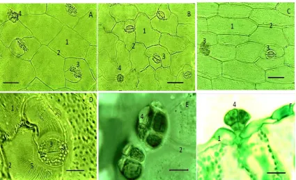 Table 1: The features in the epidermal cells of R. vesicarius leaves measured in μm. Averages of parameters in leaf epidermis m) Stomata No 