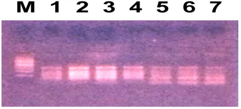 Figure 1.    PCR product of CYP2C9*2.