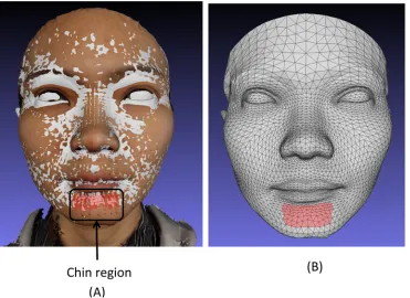 Fig 4. (A) Superimposed conformed mesh baseline (grey) and baseline textured image showing the 21landmarks of the chin region and the region in red selected on the baseline conformed mesh
