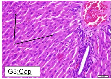 Figure 11.    Captopril 20 mg/kg group: sections from rat liver stained by H&E.