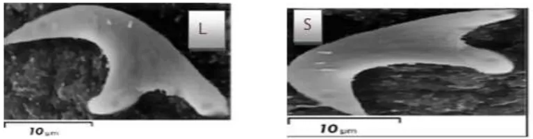 Fig. (4): Scanning electron micrographs E.granulosus A: Adult worm, Sg = Segments, 