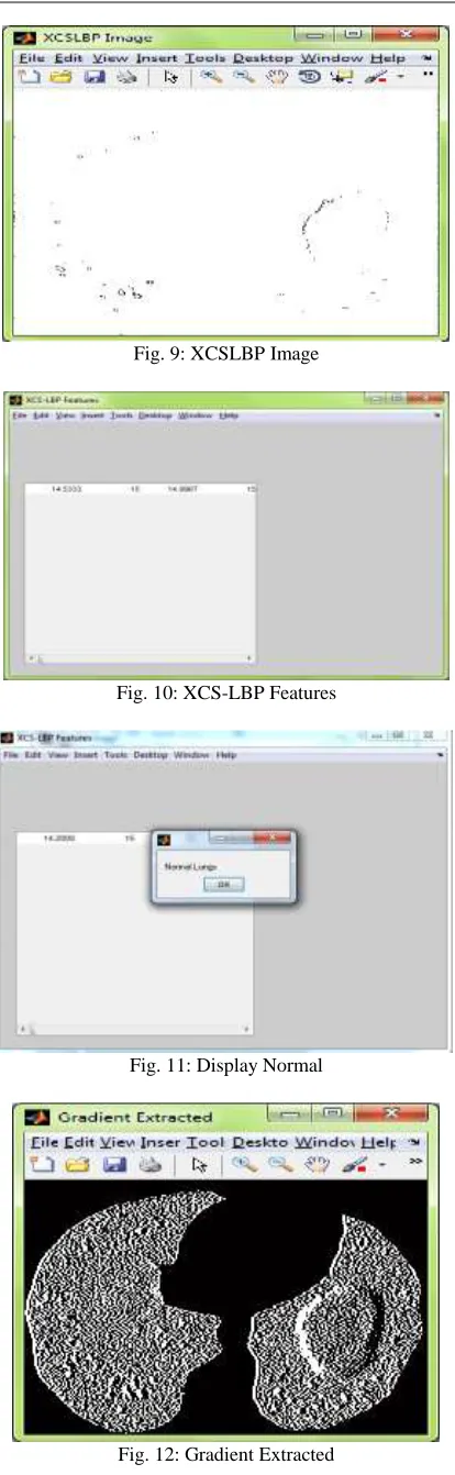 Fig. 12: Gradient Extracted 