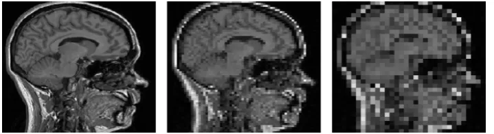 Figure 5. Linear scale space image of CT test image one 