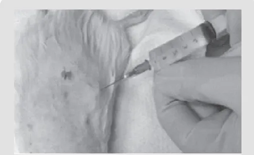 Figure  1: Stage of  injection of a suspension of adipogenic mesenchymal stem cells subfascially in the area of skin burn of III degree.