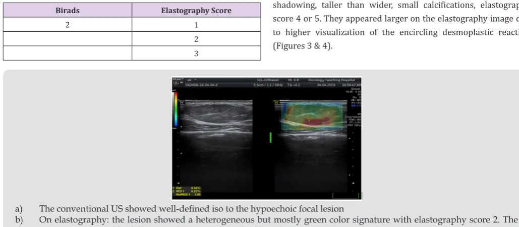 Table 6: Classification of the lesions according to the BI-RADS and elastography score.