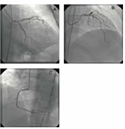 Figure 3Shows the coronaries of a normal patient as control (panels A 