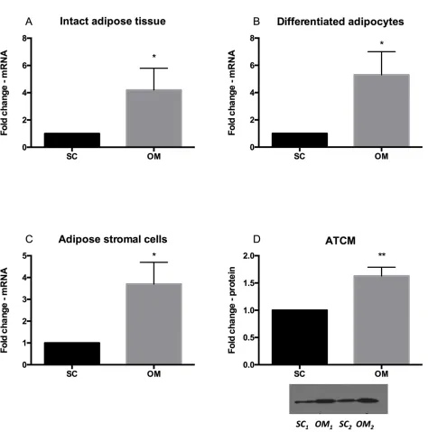 Fig 2. Relative sFRP2 mRNA expression by qPCR in (A) intact human SC and OM AT, (B) in isolated and differentiated humanadipocytes and in (C) adipose stromal cells (ASCs)