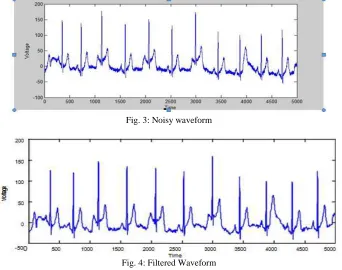 Fig. 3: Noisy waveform 