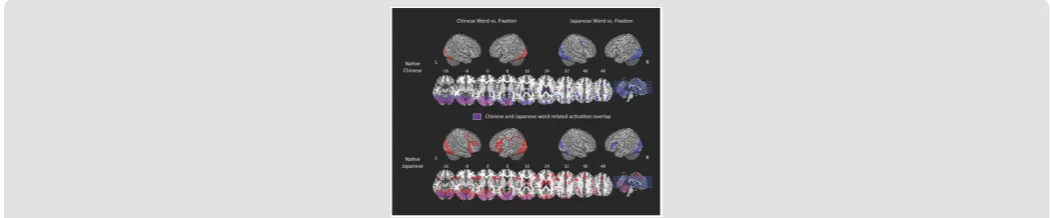 Figure 2: Whole brain activation associated with semantic processing in the bilinguals