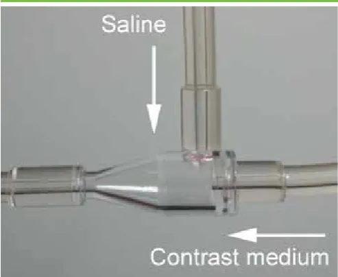 Figure 1. The chamber at the connecting site generates a  spiral flow which allows saline chaser to effectively push  contrast medium.