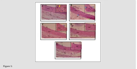Figure 1: a. Shows the histology of the aorta in normal circumstances.