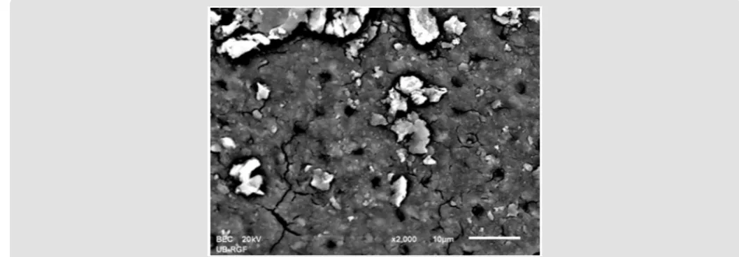 Figure 1b: SEM micrographs (2000 x) of the precipitate on the surface of dentin root canal after CHX irrigation in middle third.