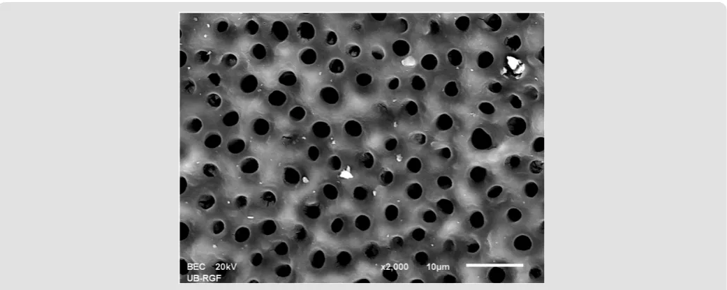 Figure 3a: SEM micrographs (2000 x) of the precipitate on the surface of dentin root canal after MTAD irrigation in appical third.
