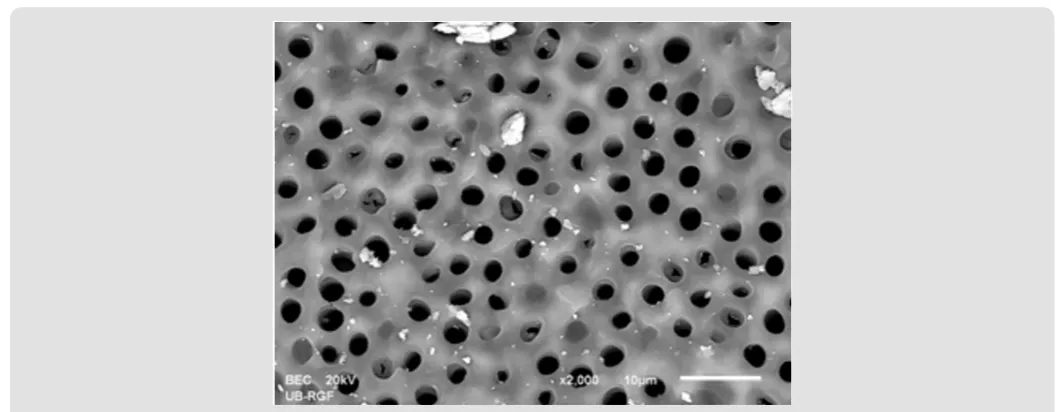 Figure 4a: SEM micrographs (2000 x) of the precipitate on the surface of dentin root canal after QMiX irrigation in appical third.