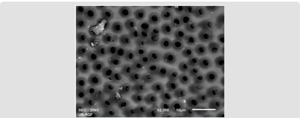 Figure 5a: SEM micrographs (2000 x) of the precipitate on the surface of dentin root canal after distilled water irrigation in apical third.