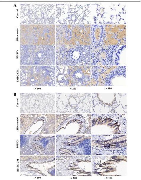 Fig. 9 Immunohistochemical expression and localization of P-GSK-3β (a) and β-catenin (b) in lung tissues of each group, magnification × 100, × 200,and × 400