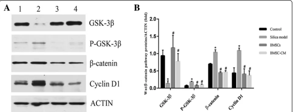 Fig. 10 The expression levels of GSK-3β, P-GSK-3β, β-catenin, Cyclin D1, and β-actin proteins of lung tissue in rats on the 56th day after exposureto silica suspension
