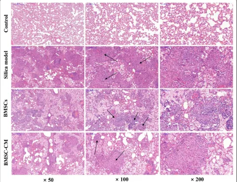 Fig. 5 Lung histopathology on the 56th day after exposure to silica suspension in each group: H&E staining of lung tissue, magnification × 50, × 100,and × 200 (arrows indicate massive aggregation of inflammatory cells and fibrotic lesions)