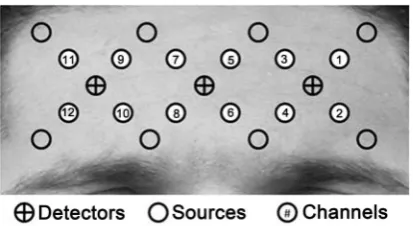 Figure 1. Location of optodes and channels. 