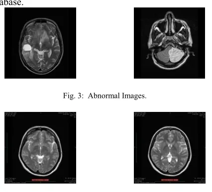 Fig. 3:  Abnormal Images. 