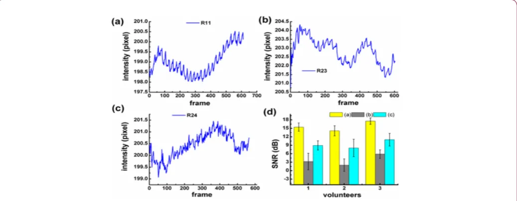 Figure 4: Results for the waveforms of finger(a), central palm(b) and palmar root(c), and their SNRs(d)
