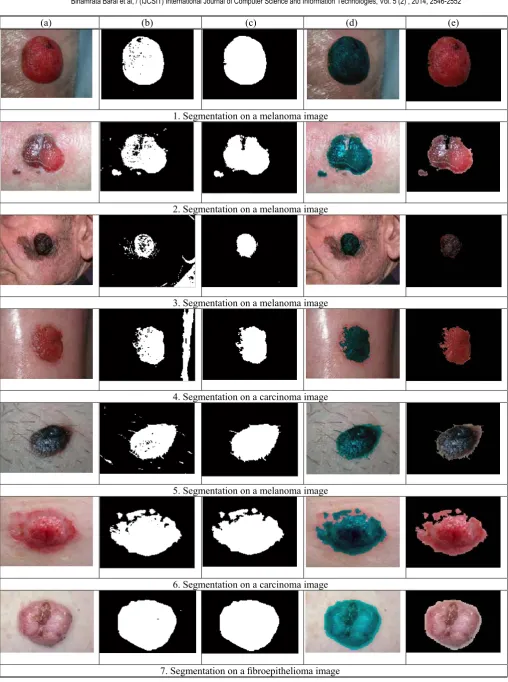 Fig. 12. Segmentation on different lesion images. Column (a) shows the original image