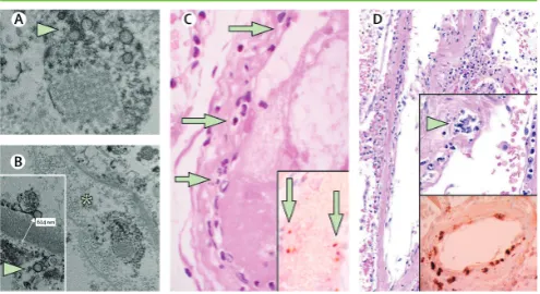Figure 2.Pathology of endothelial cell dysfunction in COVID-19 and viral 