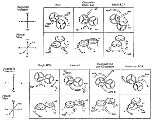 Figure 2: Coronary artery patterns in tgA. 1. Leiden classification. upper panels show coronary artery distribution as visualized by 2D echocardiography and caudally angulated aortography