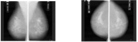 Figure 1: Illustrates the Medio lateral and Cranio-caudal view [15] 