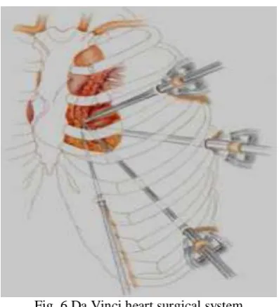 Fig. 6 Da Vinci heart surgical system  