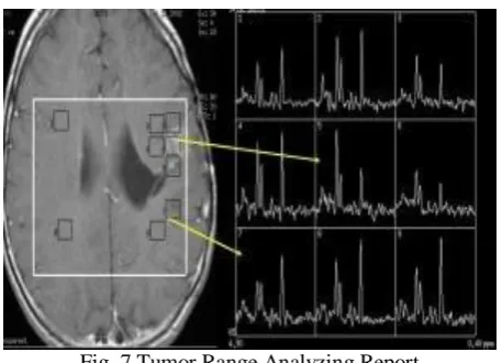 Fig. 7 Tumor Range Analyzing Report  