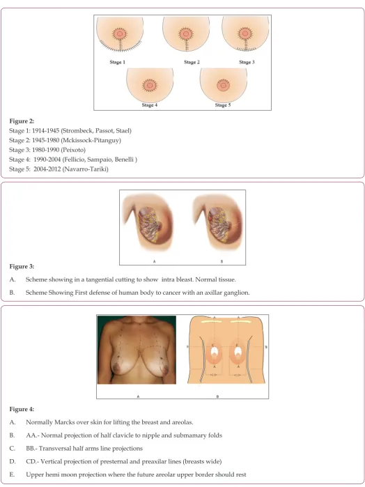 Figure 2: Stage 1: 1914-1945 (Strombeck, Passot, Stael)