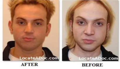 Fig. 1 The effect of plastic surgery on facial appearances. 