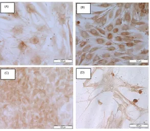 Fig. 5 The VCAM-1 and ICAM-3 were expressed at 70kDa in all four types of cells, with higher expression level for VCAM-1 in relative to control β-actin