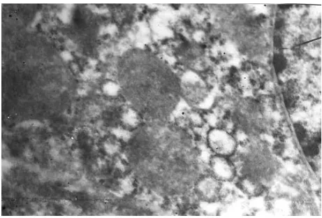 Figure 1. The ultrastructure of neurons at 2 h compression. X 20.000. 
