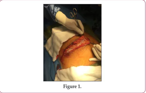 Figure 1.Figure 3.