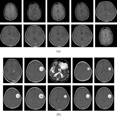Figure 1: Sample MRI image dataset, (a) MRI images without tumor (b) MRI tumor images 