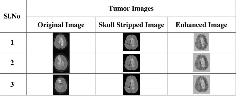 figure 3 and 4. In figure 3 and 4, the MRI image with and without tumor along with the intermediate results of original tumor 